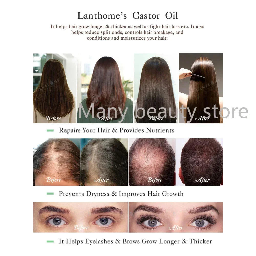 Lanthome Castor Oil Eyelash Growth Serum Hair Growth Treatment Preventing Baldness Anti Hair Loss Nourishing Roots Care 10ml